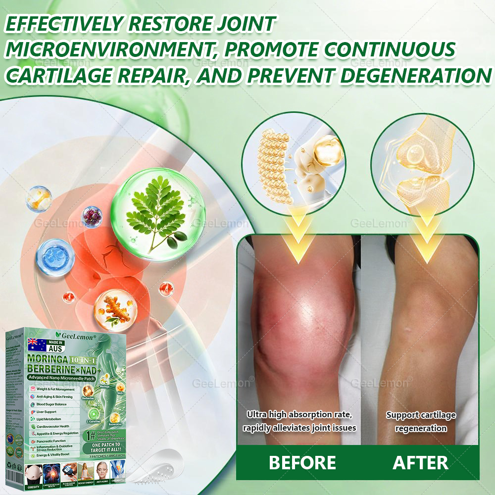 𝐆𝐞𝐞𝐋𝐞𝐦𝐨𝐧® 𝐌𝐨𝐫𝐢𝐧𝐠𝐚 · 𝐁𝐞𝐫𝐛𝐞𝐫𝐢𝐧𝐞 × 𝐍𝐀𝐃+ 𝟏𝟎-𝐢𝐧-𝟏 𝐀𝐝𝐯𝐚𝐧𝐜𝐞𝐝 𝐍𝐚𝐧𝐨 𝐌𝐢𝐜𝐫𝐨𝐧𝐞𝐞𝐝𝐥𝐞 𝐏𝐚𝐭𝐜𝐡 — 🇺(𝐉𝐮𝐬𝐭 𝐨𝐧𝐜𝐞 𝐚 𝐝𝐚𝐲, 𝐯𝐢𝐬𝐢𝐛𝐥𝐞 𝐜𝐡𝐚𝐧𝐠𝐞𝐬 𝐢𝐧 𝟕 𝐝𝐚𝐲𝐬）𝘽𝙚𝙧𝙗𝙚𝙧𝙞𝙣𝙚 + 𝙈𝙤𝙧𝙞𝙣𝙜𝙖 𝙁𝙤𝙧𝙢𝙪𝙡𝙖 ✅ 𝐅𝐨𝐫 𝐨𝐛𝐞𝐬𝐢𝐭𝐲, 𝗟𝗼𝗼𝘀𝗲 𝘀𝗸𝗶𝗻,𝐝𝐢𝐚𝐛𝐞𝐭𝐞𝐬, 𝐬𝐥𝐞𝐞𝐩 𝐚𝐩𝐧𝐞𝐚, 𝐣𝐨𝐢𝐧𝐭 𝐢𝐬𝐬𝐮𝐞𝐬, 𝐚𝐧𝐝 𝐦𝐨𝐫𝐞 💥