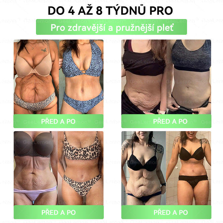 Oficiální český obchod ✨ 𝐆𝐞𝐞𝐋𝐞𝐦𝐨𝐧® 8v1 Nanomikrojehlicové náplasti na formování těla 🇨🇿 Pouze 1 použití denně ✅ Výsledky viditelné již za 7 dní – vhodné pro obezitu, kardiovaskulární zdraví, cukrovku a problémy s klouby. (Copy)