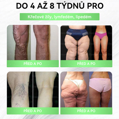 Oficiální český obchod ✨ 𝐆𝐞𝐞𝐋𝐞𝐦𝐨𝐧® 8v1 Nanomikrojehlicové náplasti na formování těla 🇨🇿 Pouze 1 použití denně ✅ Výsledky viditelné již za 7 dní – vhodné pro obezitu, kardiovaskulární zdraví, cukrovku a problémy s klouby. (Copy)
