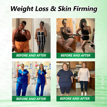 𝐆𝐞𝐞𝐋𝐞𝐦𝐨𝐧® 𝐌𝐨𝐫𝐢𝐧𝐠𝐚 · 𝐁𝐞𝐫𝐛𝐞𝐫𝐢𝐧𝐞 × 𝐍𝐀𝐃+ 𝟏𝟎-𝐢𝐧-𝟏 𝐀𝐝𝐯𝐚𝐧𝐜𝐞𝐝 𝐍𝐚𝐧𝐨 𝐌𝐢𝐜𝐫𝐨𝐧𝐞𝐞𝐝𝐥𝐞 𝐏𝐚𝐭𝐜𝐡 — 🇺(𝐉𝐮𝐬𝐭 𝐨𝐧𝐜𝐞 𝐚 𝐝𝐚𝐲, 𝐯𝐢𝐬𝐢𝐛𝐥𝐞 𝐜𝐡𝐚𝐧𝐠𝐞𝐬 𝐢𝐧 𝟕 𝐝𝐚𝐲𝐬）𝘽𝙚𝙧𝙗𝙚𝙧𝙞𝙣𝙚 + 𝙈𝙤𝙧𝙞𝙣𝙜𝙖 𝙁𝙤𝙧𝙢𝙪𝙡𝙖 ✅ 𝐅𝐨𝐫 𝐨𝐛𝐞𝐬𝐢𝐭𝐲, 𝗟𝗼𝗼𝘀𝗲 𝘀𝗸𝗶𝗻,𝐝𝐢𝐚𝐛𝐞𝐭𝐞𝐬, 𝐬𝐥𝐞𝐞𝐩 𝐚𝐩𝐧𝐞𝐚, 𝐣𝐨𝐢𝐧𝐭 𝐢𝐬𝐬𝐮𝐞𝐬, 𝐚𝐧𝐝 𝐦𝐨𝐫𝐞 💥