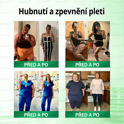 Oficiální obchod 🍀 Funutri® 10 v 1 metabolická tvarující náplast s nano mikrojehličkami (Pouze jednou denně, viditelné změny již za 7 dní)  Určeno pro osoby s obezitou, diabetem, spánkovou apnoe