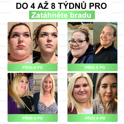 Oficiální obchod 🍀 Funutri® 10 v 1 metabolická tvarující náplast s nano mikrojehličkami (Pouze jednou denně, viditelné změny již za 7 dní)  Určeno pro osoby s obezitou, diabetem, spánkovou apnoe