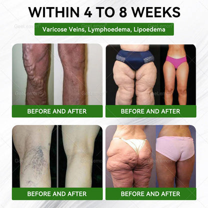 𝐆𝐞𝐞𝐋𝐞𝐦𝐨𝐧® 𝐌𝐨𝐫𝐢𝐧𝐠𝐚 · 𝐁𝐞𝐫𝐛𝐞𝐫𝐢𝐧𝐞 × 𝐍𝐀𝐃+ 𝟏𝟎-𝐢𝐧-𝟏 𝐀𝐝𝐯𝐚𝐧𝐜𝐞𝐝 𝐍𝐚𝐧𝐨 𝐌𝐢𝐜𝐫𝐨𝐧𝐞𝐞𝐝𝐥𝐞 𝐏𝐚𝐭𝐜𝐡 — 🇺(𝐉𝐮𝐬𝐭 𝐨𝐧𝐜𝐞 𝐚 𝐝𝐚𝐲, 𝐯𝐢𝐬𝐢𝐛𝐥𝐞 𝐜𝐡𝐚𝐧𝐠𝐞𝐬 𝐢𝐧 𝟕 𝐝𝐚𝐲𝐬）𝘽𝙚𝙧𝙗𝙚𝙧𝙞𝙣𝙚 + 𝙈𝙤𝙧𝙞𝙣𝙜𝙖 𝙁𝙤𝙧𝙢𝙪𝙡𝙖 ✅ 𝐅𝐨𝐫 𝐨𝐛𝐞𝐬𝐢𝐭𝐲, 𝗟𝗼𝗼𝘀𝗲 𝘀𝗸𝗶𝗻,𝐝𝐢𝐚𝐛𝐞𝐭𝐞𝐬, 𝐬𝐥𝐞𝐞𝐩 𝐚𝐩𝐧𝐞𝐚, 𝐣𝐨𝐢𝐧𝐭 𝐢𝐬𝐬𝐮𝐞𝐬, 𝐚𝐧𝐝 𝐦𝐨𝐫𝐞 💥