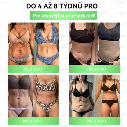 Oficiální obchod 🍀 Funutri® 10 v 1 metabolická tvarující náplast s nano mikrojehličkami (Pouze jednou denně, viditelné změny již za 7 dní)  Určeno pro osoby s obezitou, diabetem, spánkovou apnoe
